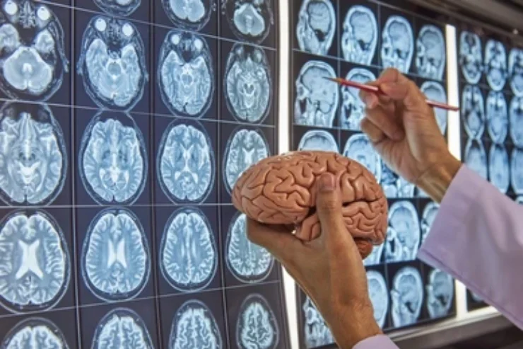 Neurology & Neuro Surgery---------13